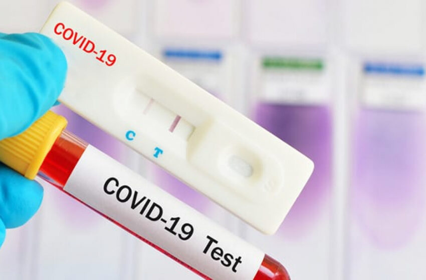  Hoy 10 Muertes, 91 Nuevos Contagios Covid Y Una Positividad Diaria Y Semanal Del 3% En La Araucanía